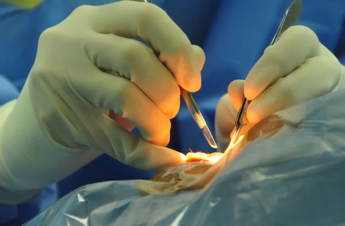 Problemas comunes de los párpados y cómo pueden ayudar los cirujanos oculofaciales.
