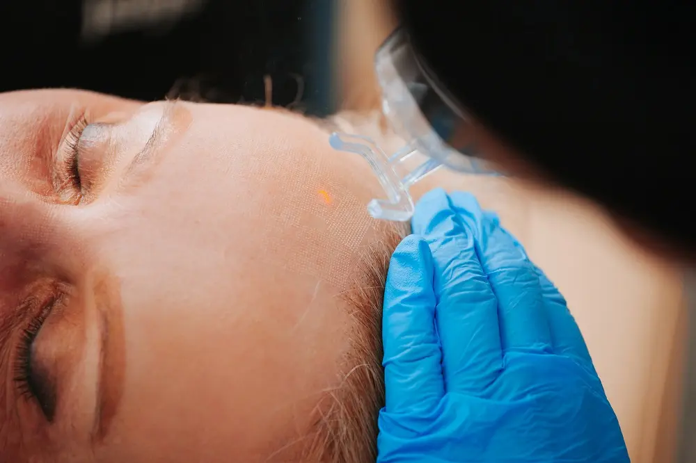 What Actually Happens During CO2 Laser Resurfacing