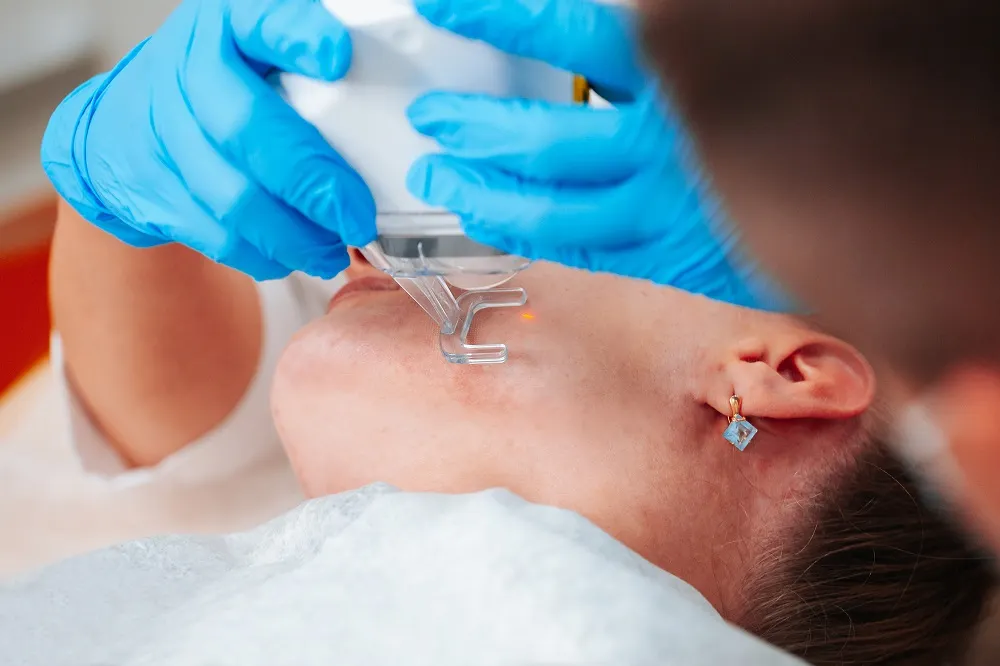 Who Is a Good Candidate for CO2 Laser Resurfacing
